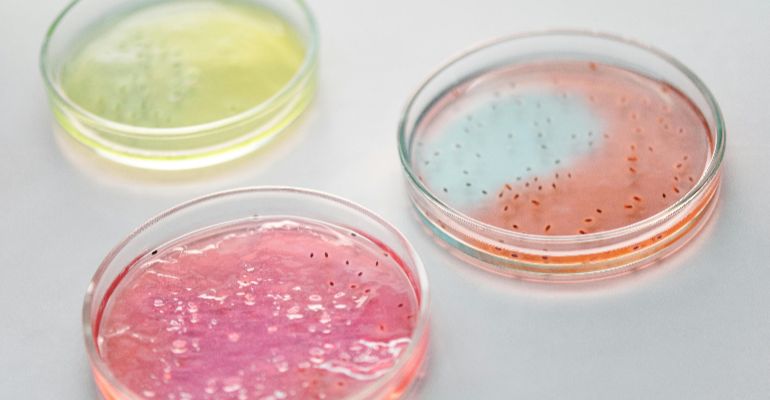 Microbiology, BS